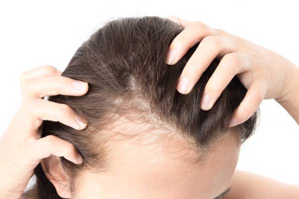 Hair & Scalp Problems | Radiance Skin Clinic