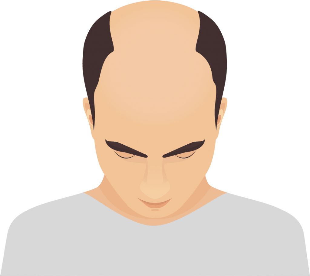 Hair & Scalp Problems Dr Surjit Mehta