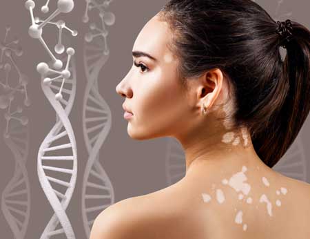 Leucoderma deals